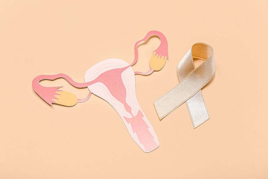 uterus and yellow endometriosis awareness ribbon